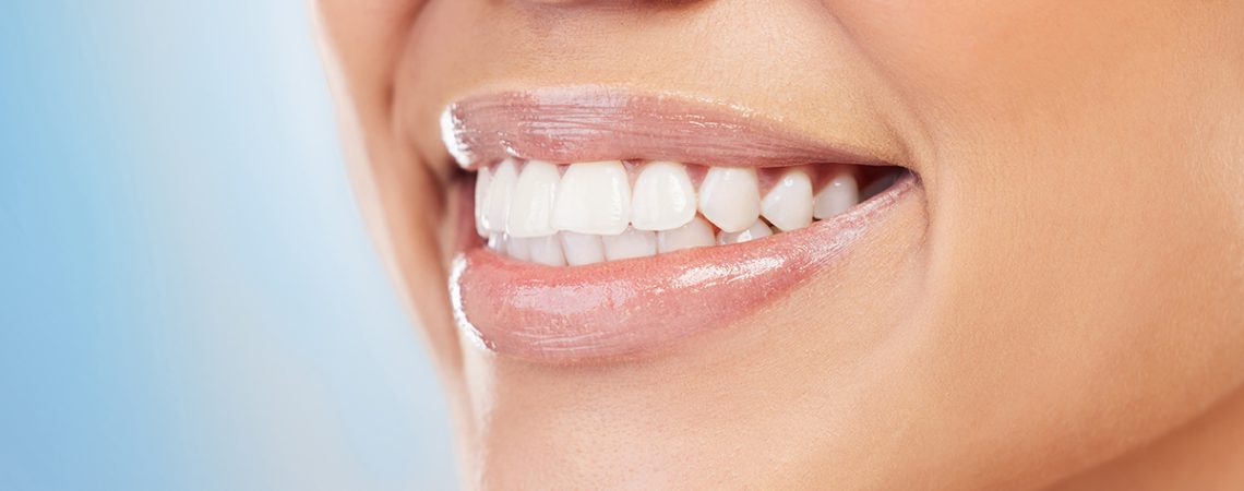 Teeth Whitening